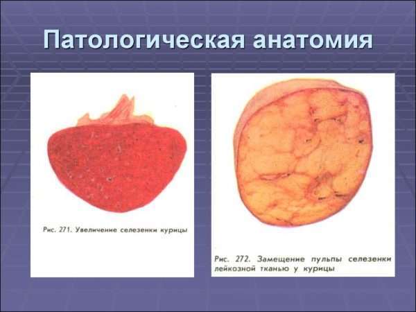 Патологическая анатомия